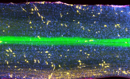 A slice through a spinal column showing the physical connection that links the brain to muscles.